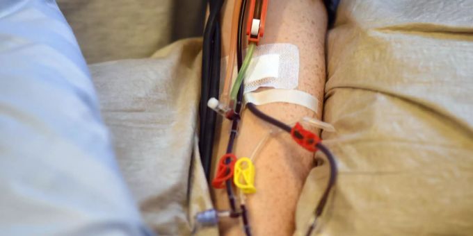 Ein Stammzellenspender liegt in einer Praxis auf einer Liege, während Stammzellen aus seinem Blut gefiltert werden. (Symbolbild) Blutkrebs