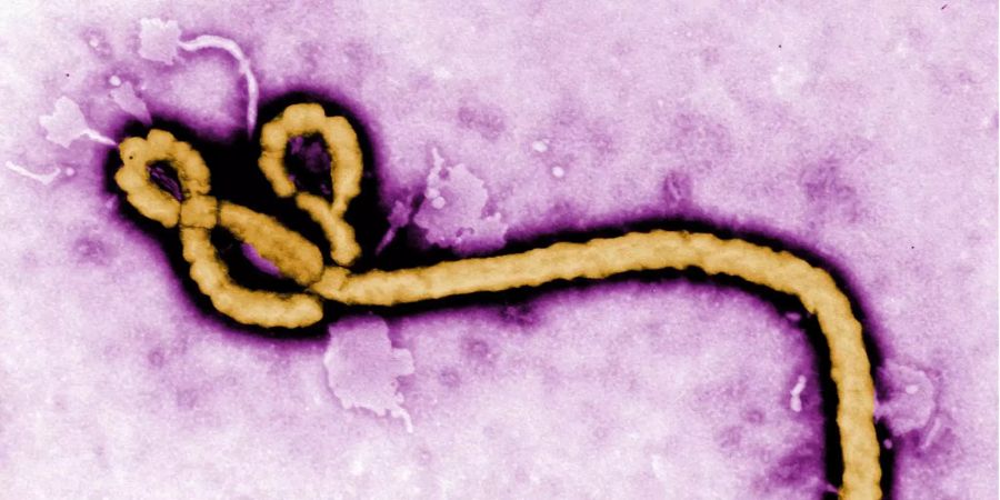 Die Aufnahme eines Elektronenmikroskops zeigt ein einzelnes Viruspartikel des Ebola-Virus.