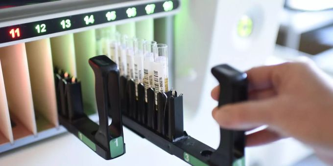 Fälle von Hepatitis bei Kindern häufen sich. hepatitis