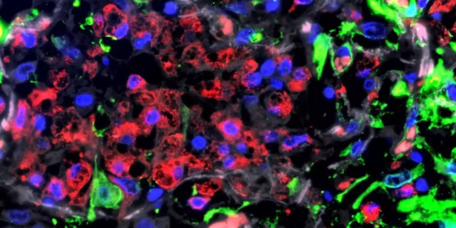 Immunfluoreszenz-Aufnahme der Lunge eines Patienten mit schwerem COVID-19. Foto: Charité/dpa