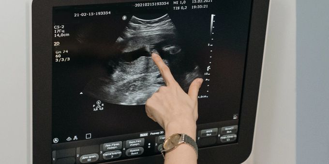Die neue Technologie verwendet Ultraschall-Wellen. Ultraschall