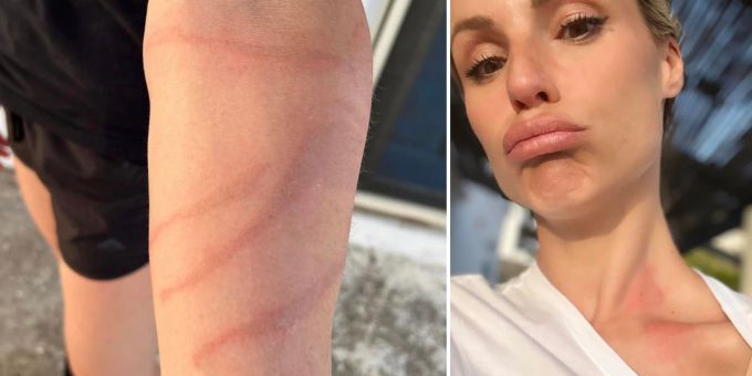Autsch! - Michelle Hunziker in Ferien von Qualle verstochen