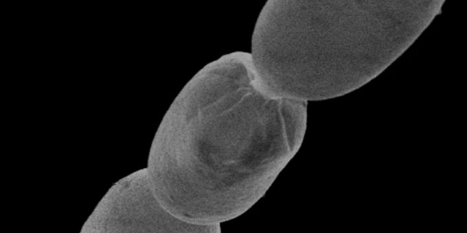 Das grösste Bakterium der Welt wurde in Guadalupe entdeckt. Bakterium