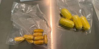 Flughafen Zürich - Kokain im Körper transportiert