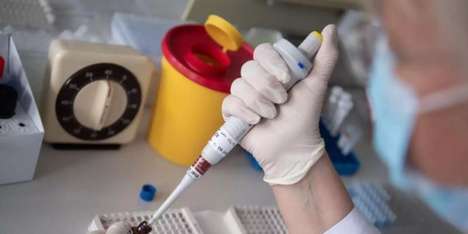 Neue Untersuchungen von Genesenen Covid-19-Patienten dämpfen die Hoffnung auf eine lang anhaltende Immunität und damit auch auf eine lange Wirksamkeit einer möglichen Impfung. Spritze Corona Impfung Covid-19