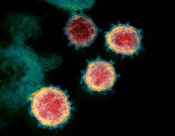 Diese undatierte elektronenmikroskopische Aufnahme, die von den U.S. National Institutes of Health im Februar 2020 zur Verfügung gestellt wurde, zeigt das neuartige Coronavirus (SARS-CoV-2), das Covid-19 verursacht. Coronavirus - Virus SARS-CoV-2