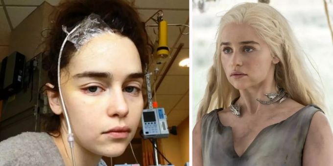 «Dachte, sterbe» - «GoT»-Star zeigt Spital-Fotos kurz nach Hirnblutung