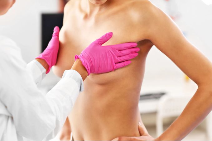 Frauengesundheit: Oft ist eine Operation notwendig, um den Krebs zu entfernen. Behandlung