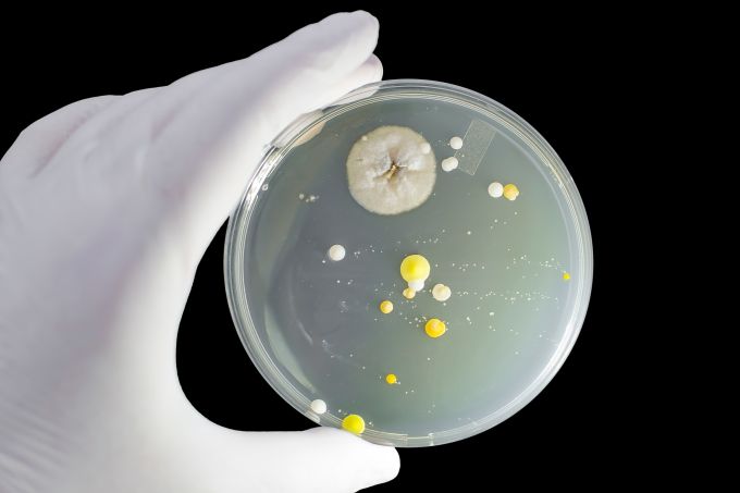 Bakterien Erreger Methode identifizieren