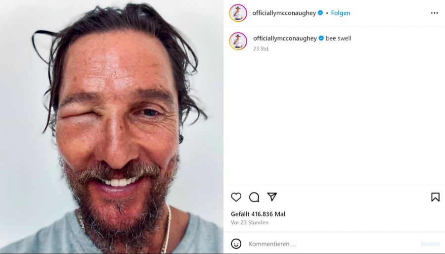 Matthew McConaughey Auge