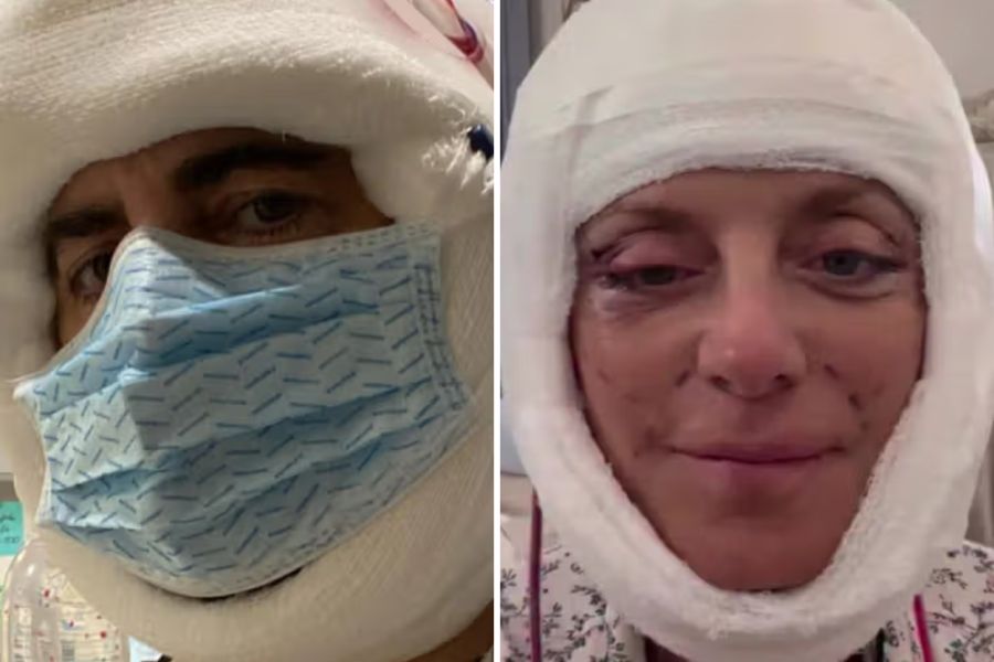 Der komplexe Eingriff wird immer beliebter. Sie haben sich auch für ein Facelift entschieden: Modeschöpfer Marc Jacobs (63, links) und Reality-Darstellerin Kathy Wakile (61, rechts).
