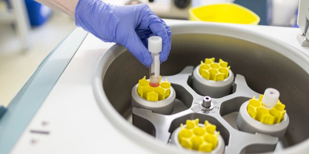 Hospital swapped sperm in artificial insemination - Archyde