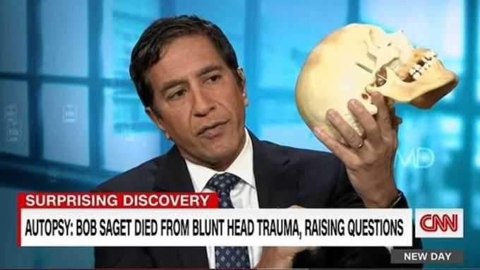 Der Arzt Sanjay Gupta erklärt die Verletzungen des Schauspielers an einem Modell. bob saget