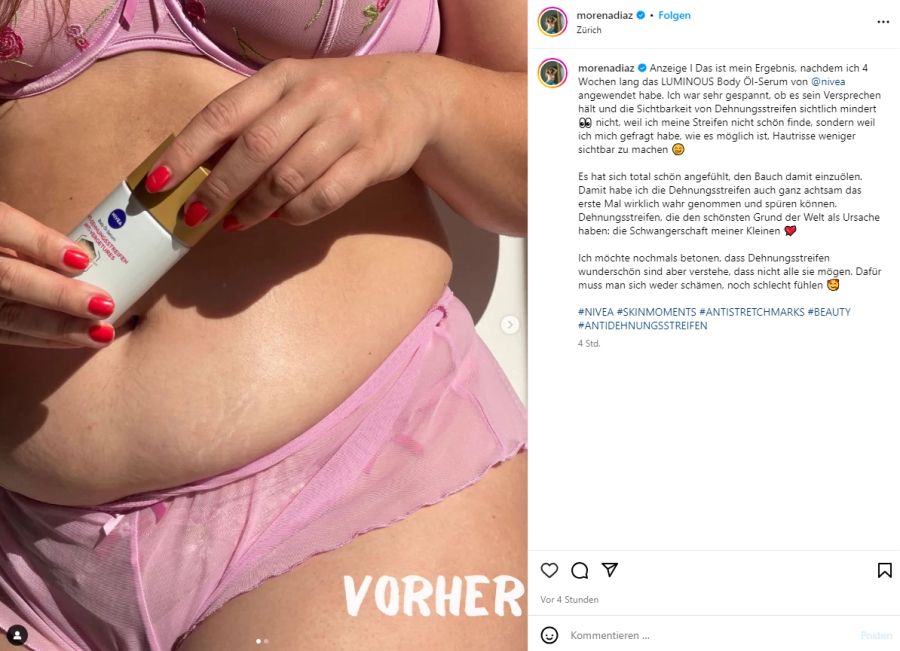 Morena Diaz macht Werbung für eine Dehnungsstreifen-Creme.