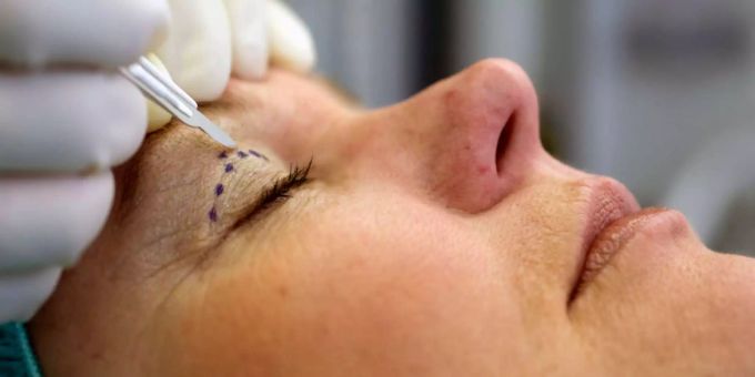 Eine Frau lässt sich bei einem Schönheitschirurg behandeln. Schönheitschirurgie Coronavirus