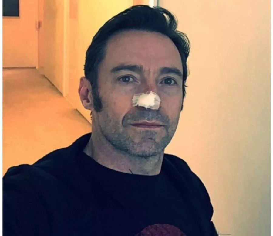 Der australische Schauspieler Hugh Jackman musste sich schon mehrmals ...