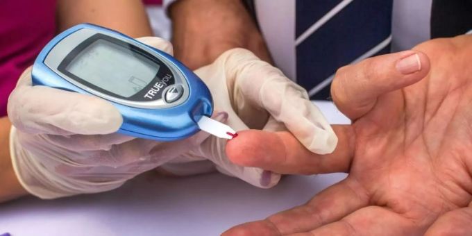 Blutprobe für einen Blutzuckertest: Dies ist nun auch aufgrund des Coronavirus häufiger nötig. diabetes mellitus coronavirus