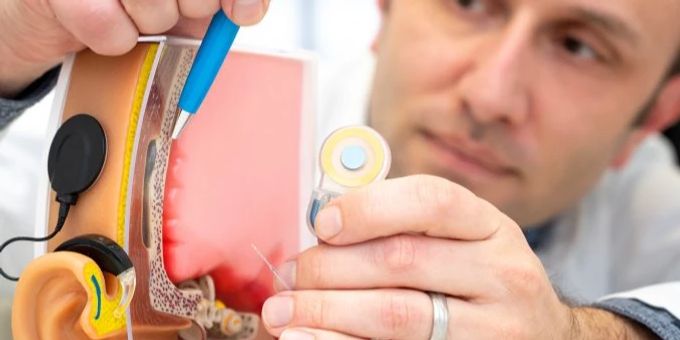 Für Cochlea-Implantat - Universitätsmedizin Halle erhält Zertifizierung