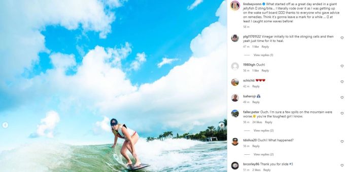 Lindsey Vonn hat beim Surfen eine unangenehme Begegnung mit einer Qualle. Lindsey Vonn Surfen Qualle