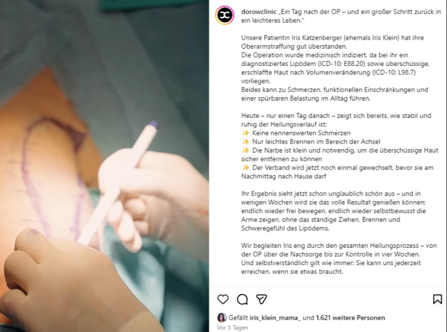 Die Oberarme des TV-Stars wurden gestrafft.