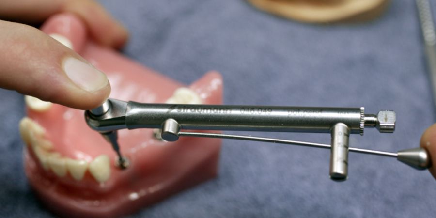 Straumann macht im Startquartal mehr Umsatz als erwartet (Symbolbild)