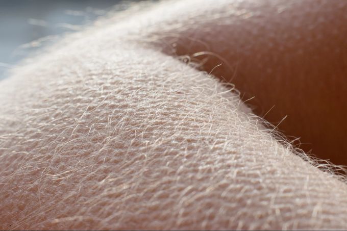 Ein evolutionär bedingter Schutzmechanismus gegen die Kälte: Gänsehaut. Gänsehaut
