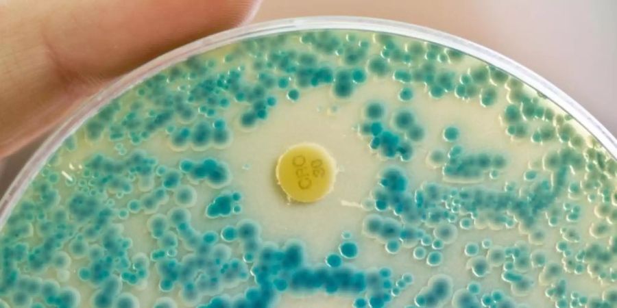 Indikatorkulturplatte zum Nachweis von resistenten Bakterien. Dem UN-Bericht zufolge werden bis 2050 voraussichtlich gegen Antibiotika widerstandsfähige Infektionen weltweit die grösste Todesursache sein. Foto: Daniel Karmann/Archiv