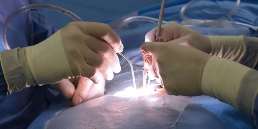 Die Patienten eines Berner Chirurgen der mutmasslich in den Implantateskandal verwickelt ist, bekommen keinen Maulkorb verpasst. Das bernische Obergericht hat die Beschwerde einer Patientin gegen die Stillschweigepflicht gutgeheissen (Themenbild).