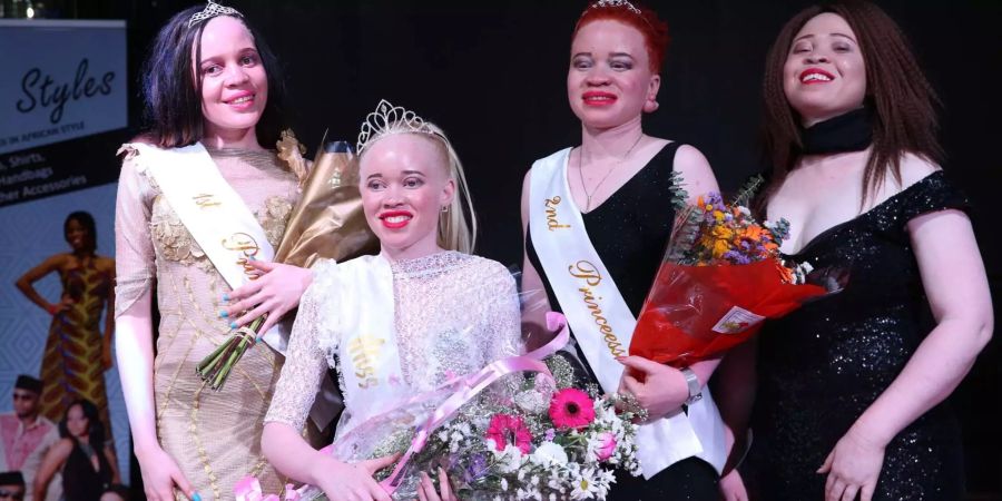 Erste Wahl der «Miss Albino Simbabwe».