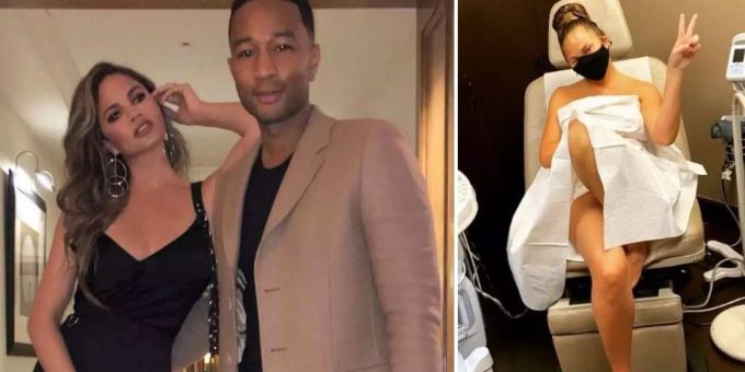 Mit Corona-Maske - Chrissy Teigen postet Foto beim Frauenarzt