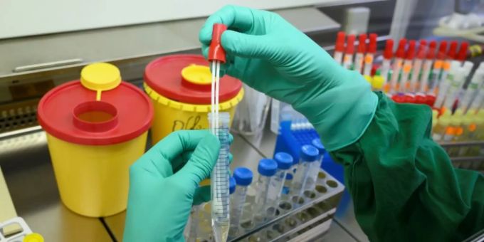 Coronavirus-Test in einem Labor thurgau st.galler