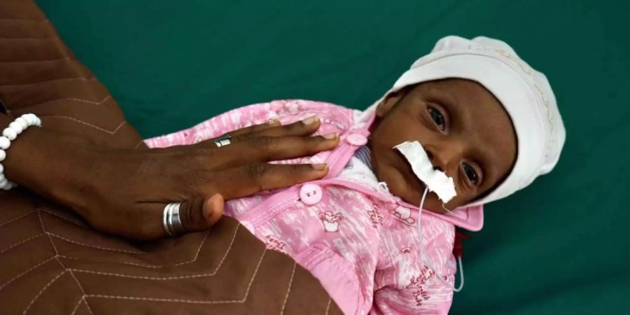 Ein wenige Wochen altes Baby, das an Unterernährung leidet, liegt in einem Krankenhaus in Aden. Foto: Giles Clarke/UNOCHA/dpa