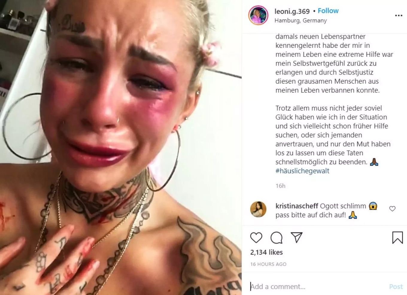 Sängerin Pinkelt Fan Ins Gesicht