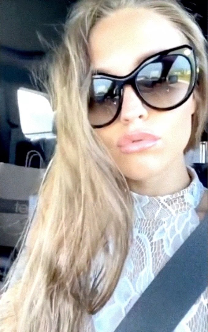 Laura Müller zeigt ihren Followern die vollen Lippen. oliver pocher