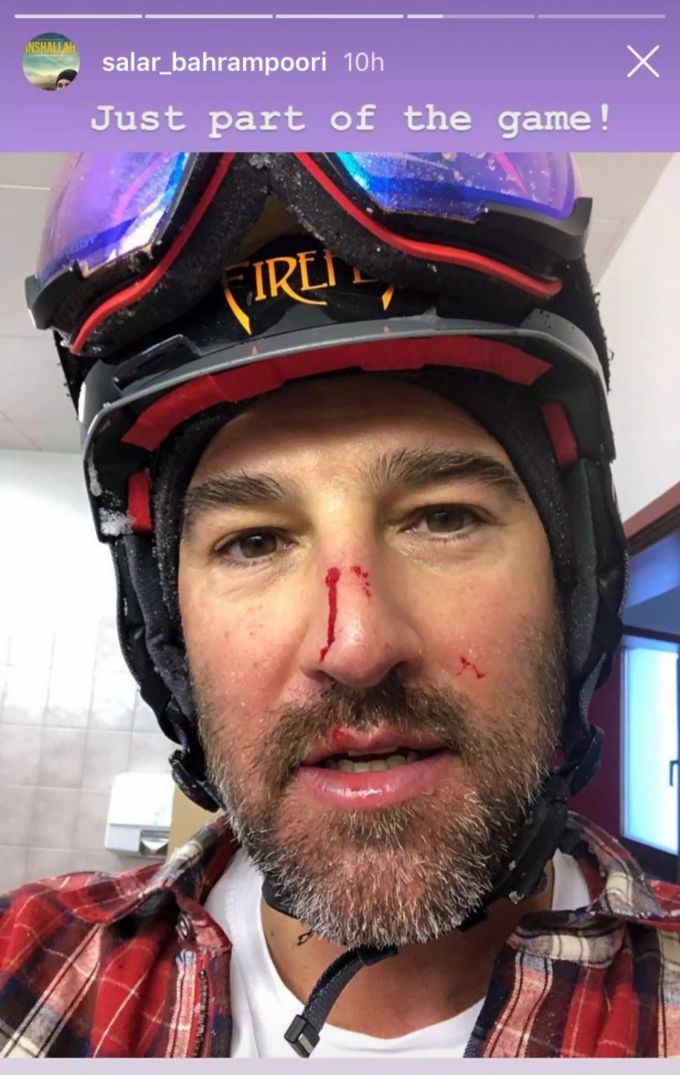 SRF-Mann Salar Bahrampoori haut sich in Davos beim Skifahren die Nase blutig. Salar Bahrampoori