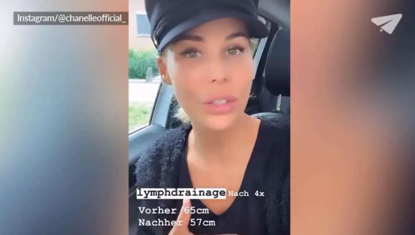 chanelle-lymphdrainage