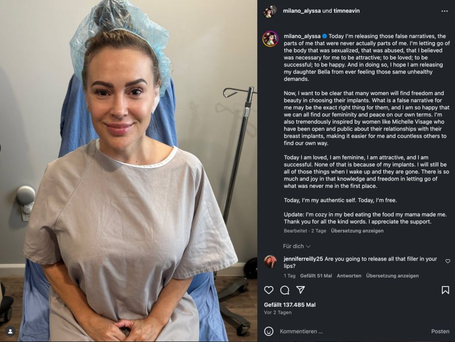 alyssa milano brustimplantate entfernen