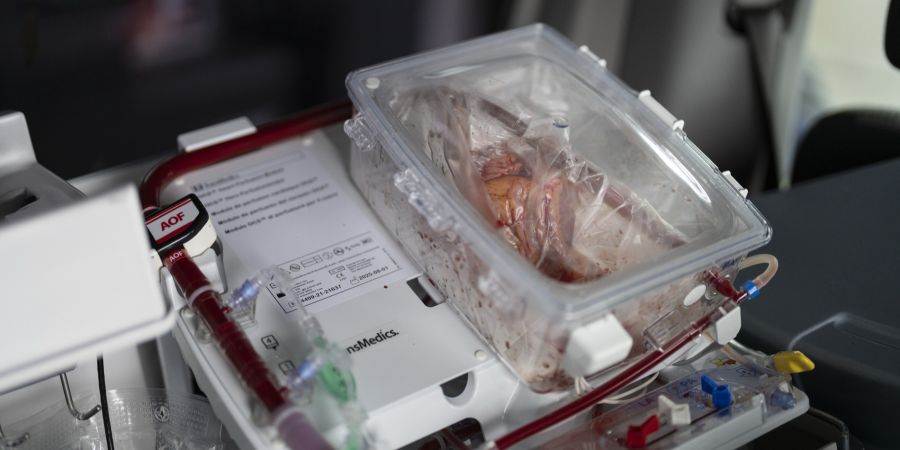 Herz Transplantation