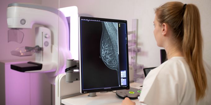 Dank moderner Bildgebung lassen sich Auffälligkeiten in der Brust frühzeitig entdecken. Gesundheit Aargau