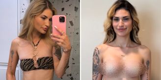 Hatte Schmerzen - Nach OP: Bachelorette Larissa zeigt ihre neuen Brüste Hatte Schmerzen - Nach OP: Bachelorette Larissa zeigt ihre neuen Brüste