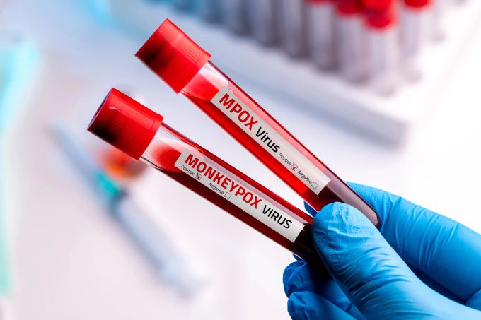Die Ergebnisse unterstreichen die Bedeutung präventiver Massnahmen und gezielter Impfempfehlungen für Risikogruppen. wirksamkeit mpox impfung