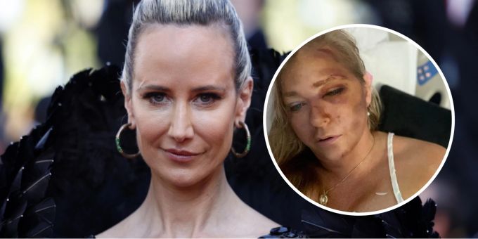 Spital-Foto - Andrews Ex schreibt brutalen Kommentar zu Sex-Klägerin