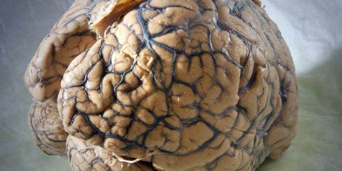 Forscherteams haben zusammen den bislang umfangreichsten Zellatlas des menschlichen Gehirns erstellt. Forscherteams haben zusammen den bislang umfangreichsten Zellatlas des menschlichen Gehirns erstellt.