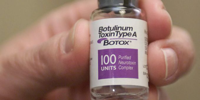 Botox Allergan Abbvie
