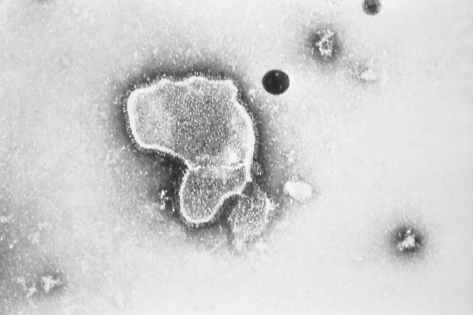 Das Respiratorische Synzytial-Virus (RSV) unter dem Elektronenmikroskop. Das RS-Virus ist ein weltweit verbreiteter Erreger von akuten Erkrankungen der oberen und unteren Atemwege. RSV Grippe
