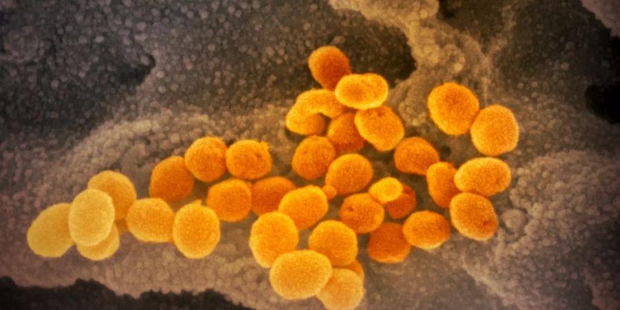 Coronavirus unter dem Elektronenmikroskop