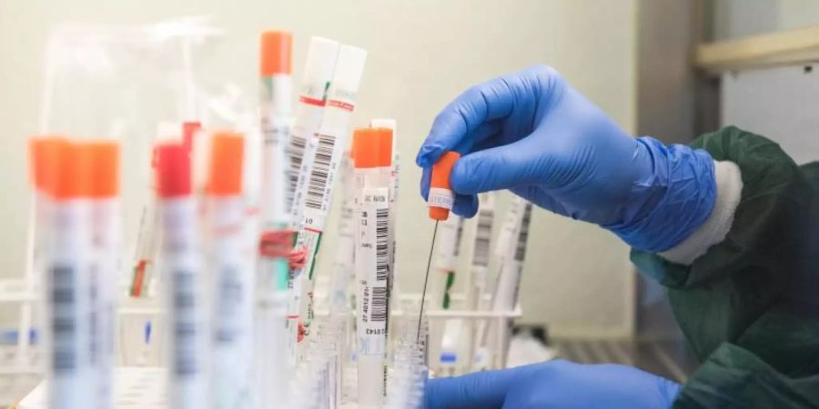 Eine Mitarbeiterin eines Labors überführt einen trockenen Abstrich eines molekularbiologischen Tests auf das SARS-CoV-2-Virus in eine Flüssigkeit. Foto: Daniel Bockwoldt/dpa