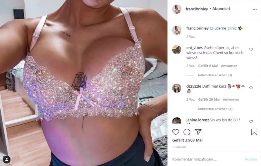 Francesca zeigte auf Instagram stolz das Resultat ihrer Busen-OP.