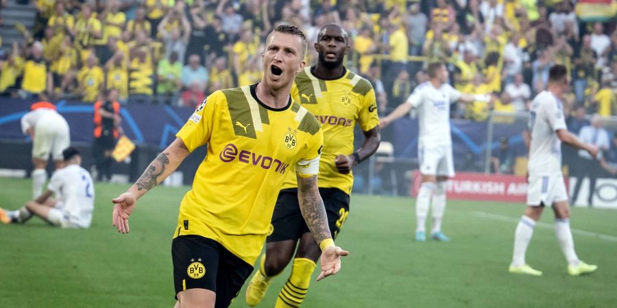 BVB-Kapitän Marco Reus steht nach seiner Aussenbandverletzung vor dem Comeback.