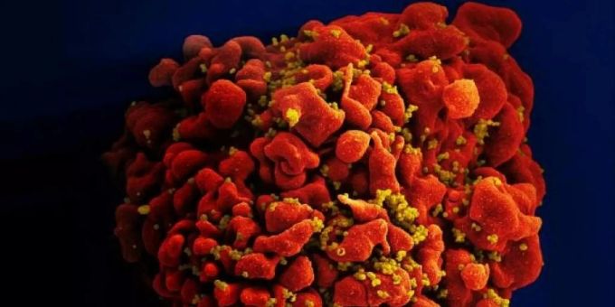 Ein vom HI-Virus befallenes Blutkörperchen Ein vom HI-Virus befallenes Blutkörperchen